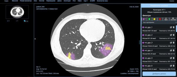 هوش مصنوعی و کرونا - اسپوتنیک ایران  