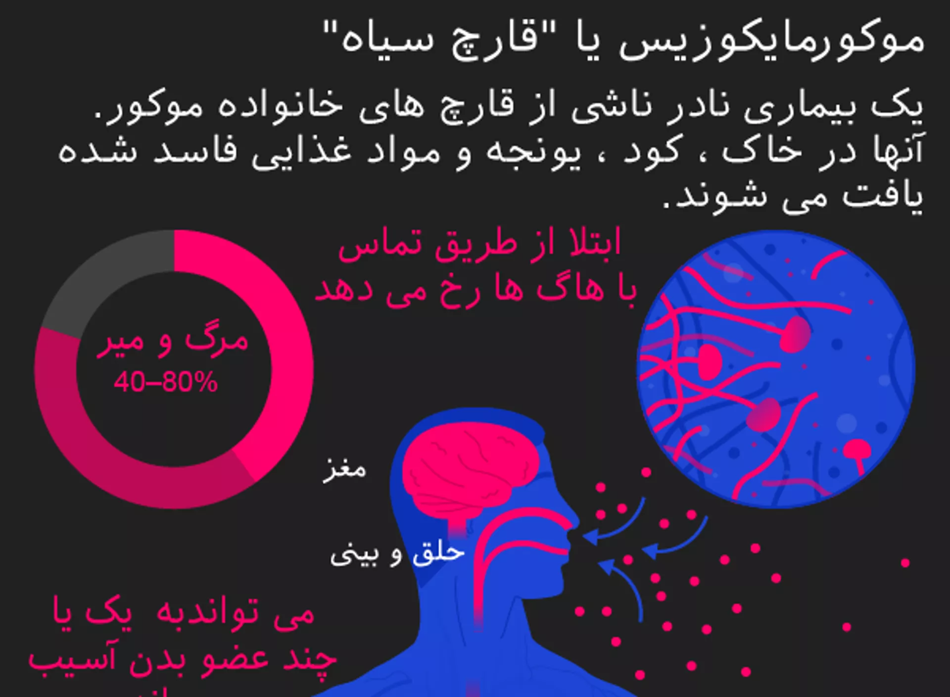 موکورمایکوزیس یا قارچ سیاه - اسپوتنیک ایران  , 1920, 22.06.2021