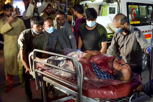  آسیب دیدگان انفجارات شدید در کابل - اسپوتنیک ایران  