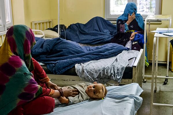 کودک افغان که پس از مجروح شدن در زمین لرزه ۲۲ ژوئن ۲۰۲۲ در ولسوالی گایان، ولایت پکتیکا، در بیمارستانی در شهر شاران تحت مداوا قرار دارد. - اسپوتنیک ایران  