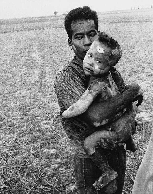 کودکی که بدنش پر از سوختگی های ناشی از بمب ناپالم است، در آغوش پدرش، 19 مارس 1964 - اسپوتنیک ایران  