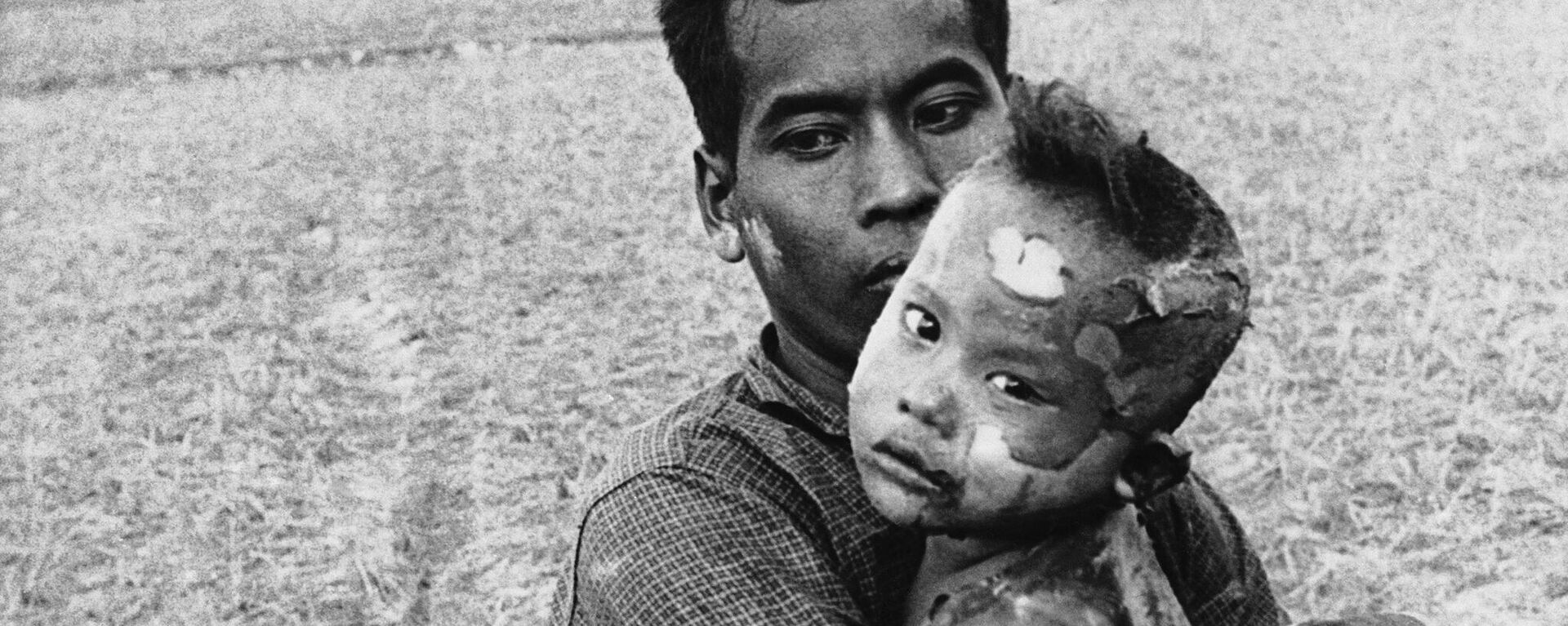 کودکی که بدنش پر از سوختگی های بمب ناپالم است، در آغوش پدرش، 19 مارس 1964 - اسپوتنیک ایران  , 1920, 11.01.2023