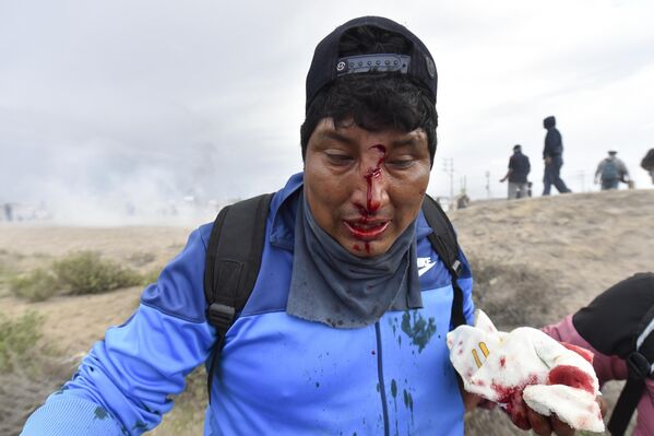 مردم به مردی که در جریان تظاهرات ضد دولتی در آرکیپا، پرو، روز پنج‌شنبه، 19 ژانویه 2023 مجروح شده، کمک می‌کنند.  - اسپوتنیک ایران  