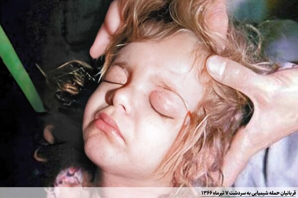 حمله شیمیایی به سردشت - اسپوتنیک ایران  