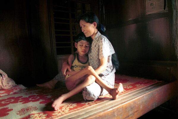 فام کوک هوی دوازده ساله توسط مادرش روی یک تخت بامبو در خانه شان،  فوریه 2000 فام طبق آنچه والدینش می گویند از اثرات عامل نارنجی برگ زدای جنگل که به شدت در منطقه توسط ایالات متحده استفاده می شود، رنج می برد.  - اسپوتنیک ایران  