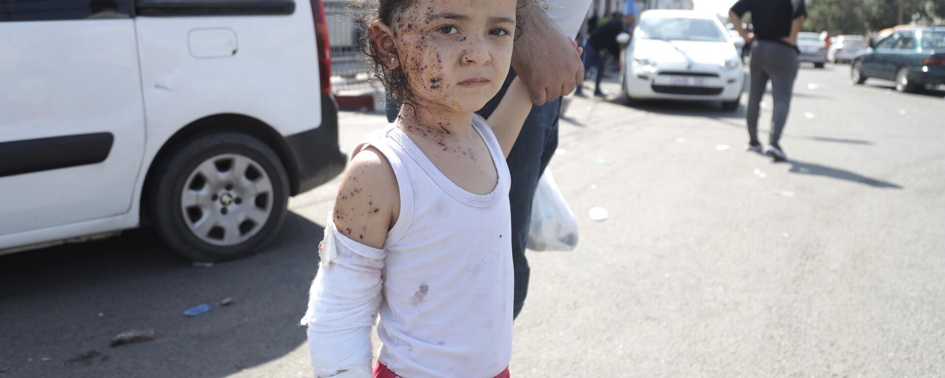 کودک زخمی  پس از حملات اسرائیل به غزه - اسپوتنیک ایران  , 1920, 31.10.2023