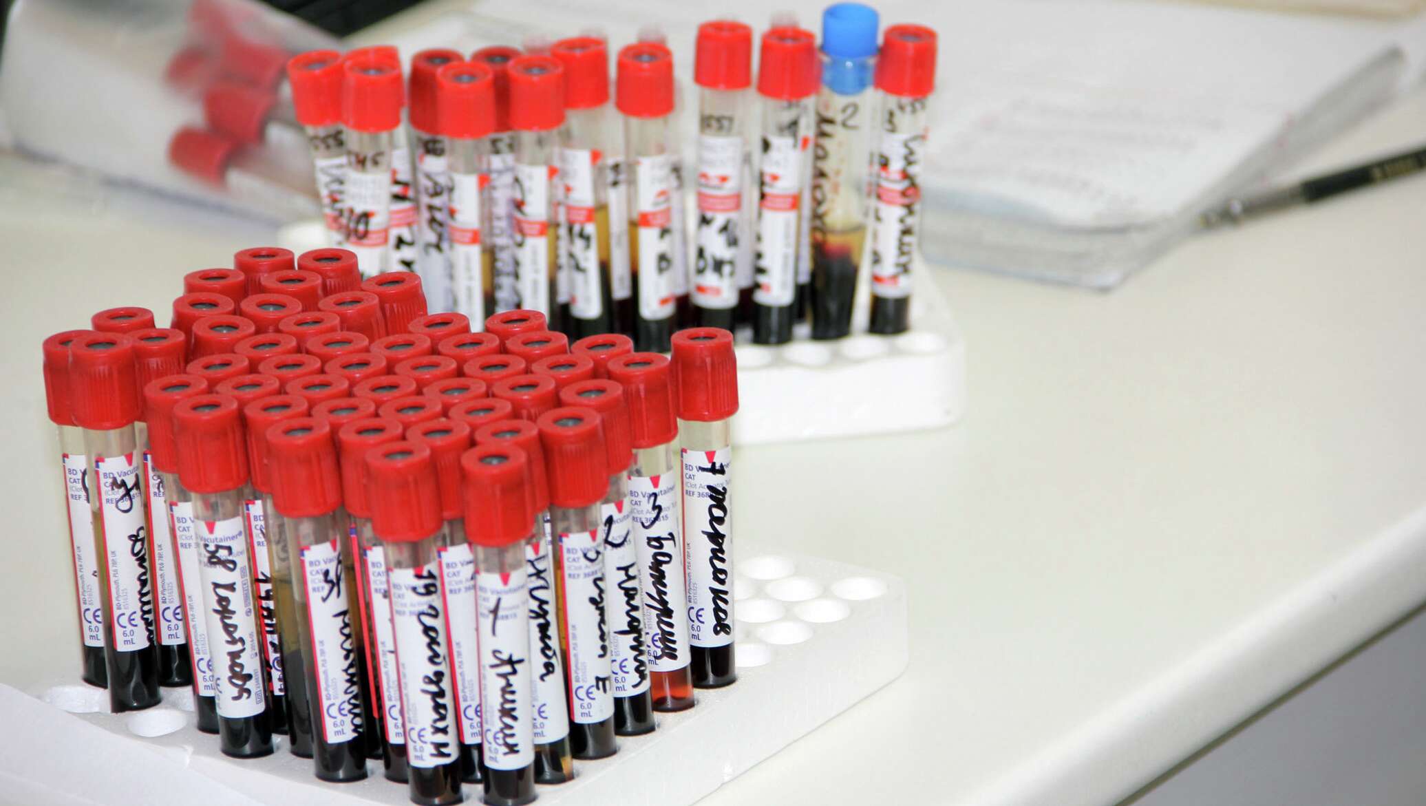 Вич пробирка. Пробирка на вич. Пробирка на вич. Вакутейнер. Пробирка на вич.