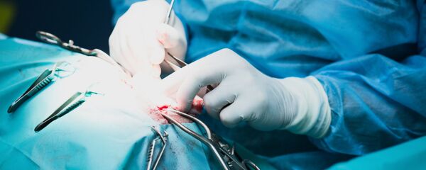 اگر آپاندیس خود را عمل کرده اید، به بیماری پارکینسون مبتلا نمی شوید اگر آپاندیس خود را عمل کرده اید، به بیماری پارکینسون مبتلا نمی شوید - اسپوتنیک ایران