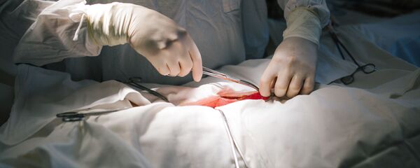 اولین جراحی پیوند سر در جهان توسط ۱۵۰ پزشک اولین جراحی پیوند سر در جهان توسط ۱۵۰ پزشک - اسپوتنیک ایران