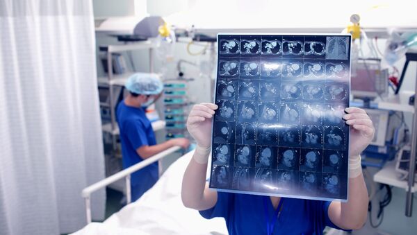 Врач рассматривает томографию мозга пациента в больнице - اسپوتنیک ایران  