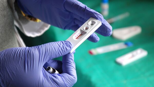 Лабораторный тест на ВИЧ - اسپوتنیک ایران  