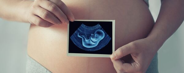 مجازات سقط جنین در آمریکا تشدید می شود مجازات سقط جنین در آمریکا تشدید می شود - اسپوتنیک ایران