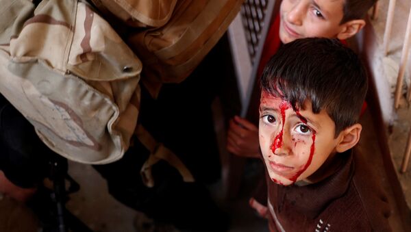 Мальчик, раненный во время боев в Мосуле, Ирак - اسپوتنیک ایران  