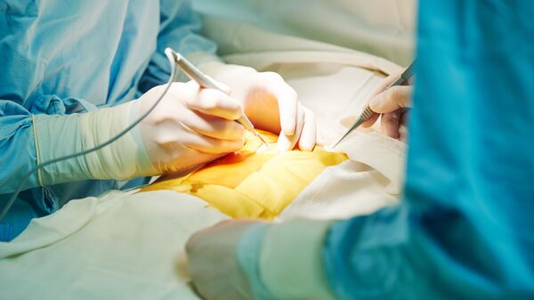 Хирург во время операции на сердце - اسپوتنیک ایران  