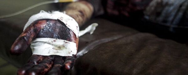 حادثه سقوط دختربچه 3 ساله در دیگ خورشت نذری در ایران +عکس - اسپوتنیک ایران  