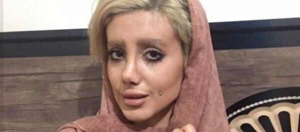 Иранка Сахар Табат, сделавшая 50 операций - اسپوتنیک ایران  