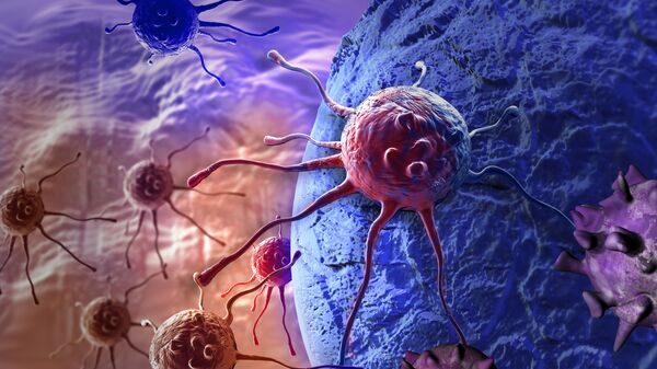 حمله سلول های سرطانی به ارگانیزم - اسپوتنیک ایران  