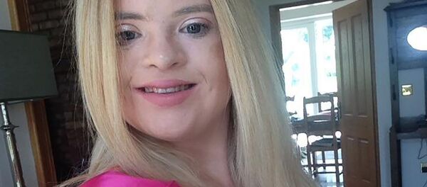 مدل بریتانیایی با سندروم داون مدل بریتانیایی با سندروم داون - اسپوتنیک ایران