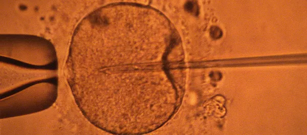 استفاده از اصلاح ژن، برای جلوگیری از رد پیوند سلول های بنیادی استفاده از اصلاح ژن، برای جلوگیری از رد پیوند سلول های بنیادی - اسپوتنیک ایران