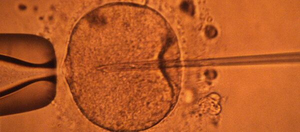 استفاده از اصلاح ژن، برای جلوگیری از رد پیوند سلول های بنیادی - اسپوتنیک ایران  