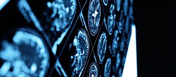 نگرانی دانشمندان از تاثیر کرونا بر مغز و سیستم عصبی نگرانی دانشمندان از تاثیر کرونا بر مغز و سیستم عصبی - اسپوتنیک ایران