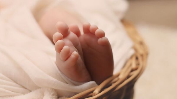 تولد نوزادی با سندرم پري دريايي در هند - اسپوتنیک ایران  