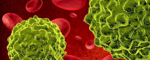 کشف مکانیزم پیشرفت انواع غیر قابل درمان سرطان
 - اسپوتنیک ایران  