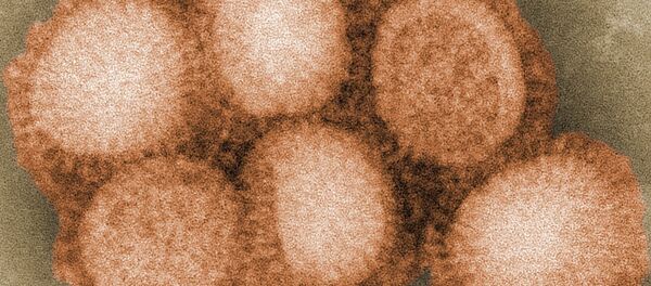 واکسیناسیون تنها راه نجات کودکان از سرخک واکسیناسیون تنها راه نجات کودکان از سرخک - اسپوتنیک ایران