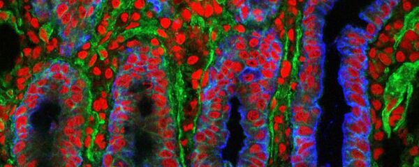 چه مواد غذایی باعث از بین رفتن روده ها می شوند؟ - اسپوتنیک ایران  