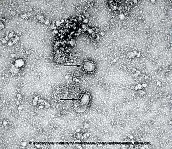 اولین عکس نوع جدید ویروس کرونا با میکروسکوپ الکترونیکی که توسط دانشمندان چینی گرفته شده است - اسپوتنیک ایران  