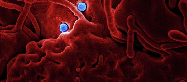 هر آنچه باید از کرونا ویروس ها بدانیم - اسپوتنیک ایران  