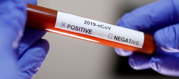 ایران قصد دارد کیت تست کرونا صادر کند ایران قصد دارد کیت تست کرونا صادر کند - اسپوتنیک ایران