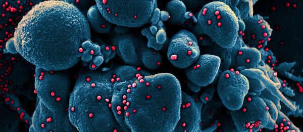 تصویر سلول مبتلا به کروناویروس زیر میکروسکوپ تصویر سلول مبتلا به کروناویروس زیر میکروسکوپ - اسپوتنیک ایران