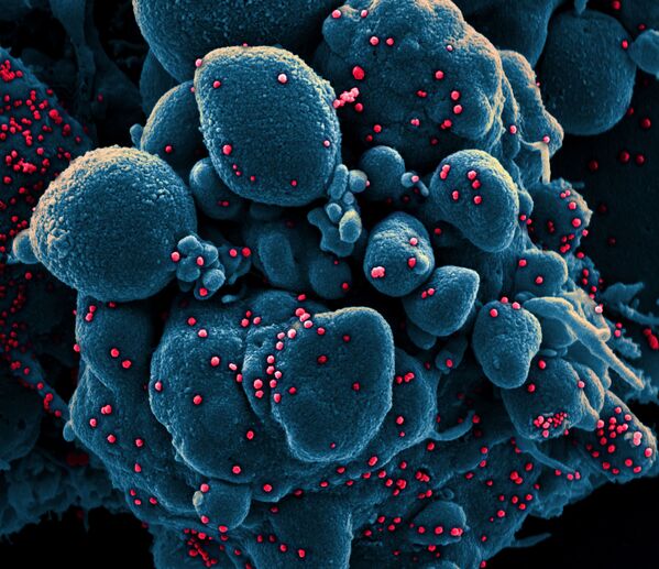 تصویر سلول مبتلا به کروناویروس زیر میکروسکوپ - اسپوتنیک ایران  