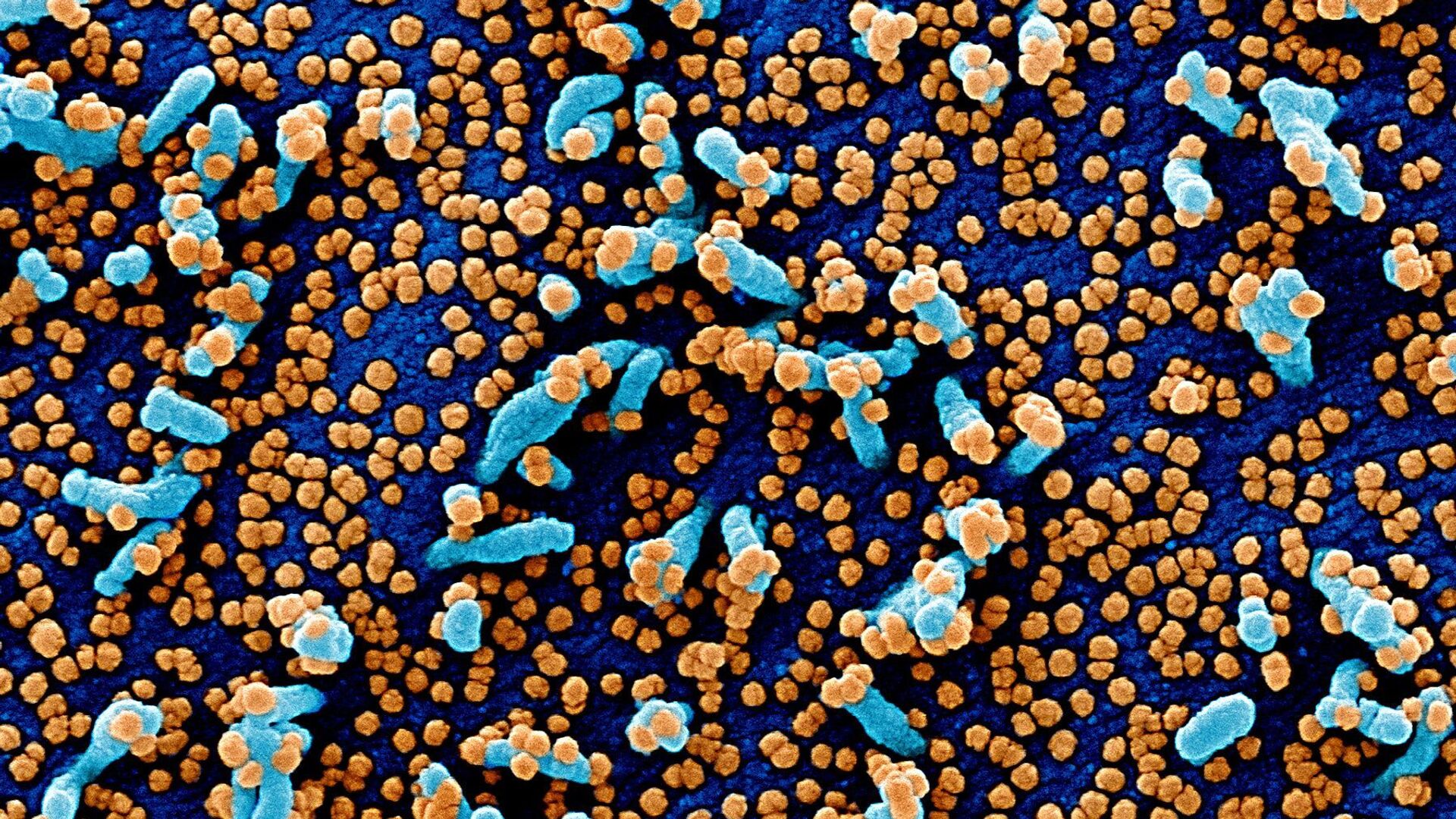 دانشمندان: سلول‌های تی بهتر از آنتی‌بادی‌ها از انسان در برابر کرونا محافظت می‌کنند - اسپوتنیک ایران  , 1920, 22.12.2021