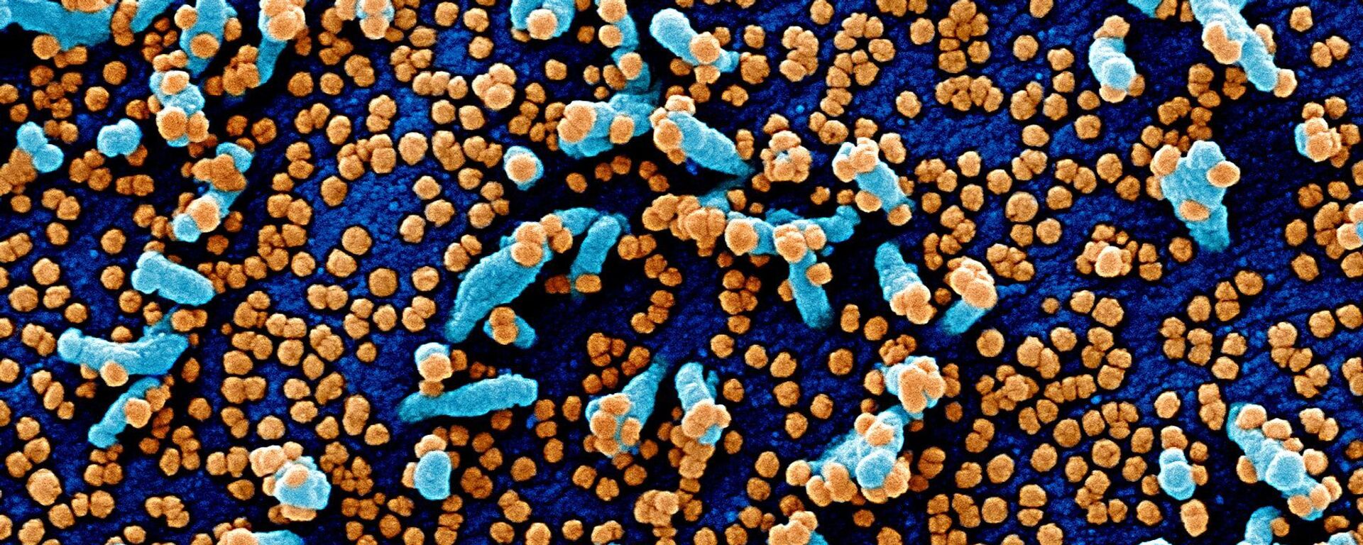 دانشمندان: سلول‌های تی بهتر از آنتی‌بادی‌ها از انسان در برابر کرونا محافظت می‌کنند - اسپوتنیک ایران  , 1920, 22.12.2021