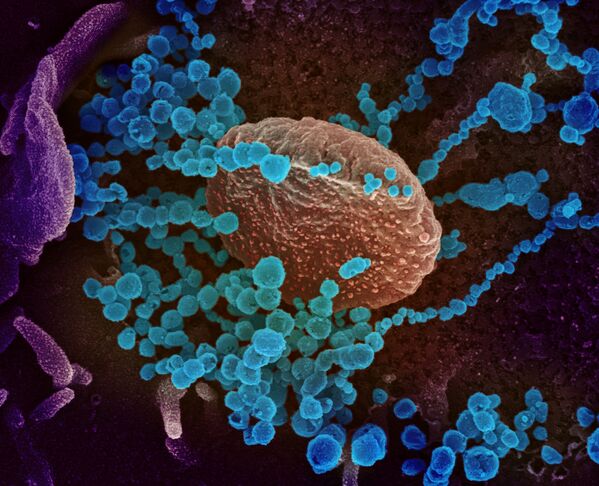 تصویر سلول مبتلا به کروناویروس زیر میکروسکوپ - اسپوتنیک ایران  
