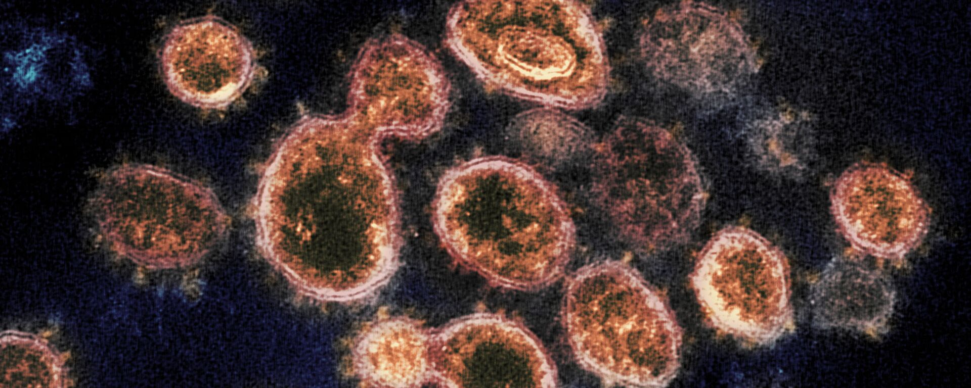 کشف روش از بین بردن ویروس کرونا طی 25 ثانیه  - اسپوتنیک ایران  , 1920, 28.11.2021