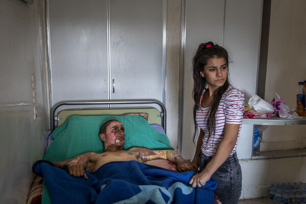 عکس Injured Kurdish Fighter Receives Hospital Visit از عکاس Ivor Prickett در مسابقه World Press Photo 2020 برنده شد - اسپوتنیک ایران  