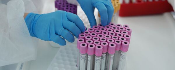 ایجاد تست تشخیص سریع پادتن کروناویروس ایجاد تست تشخیص سریع پادتن کروناویروس - اسپوتنیک ایران