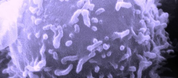 سیستم ایمنی با ابتلا به کرونا ویروس با ارگان های بدن نیز میجنگد سیستم ایمنی با ابتلا به کرونا ویروس با ارگان های بدن نیز میجنگد - اسپوتنیک ایران