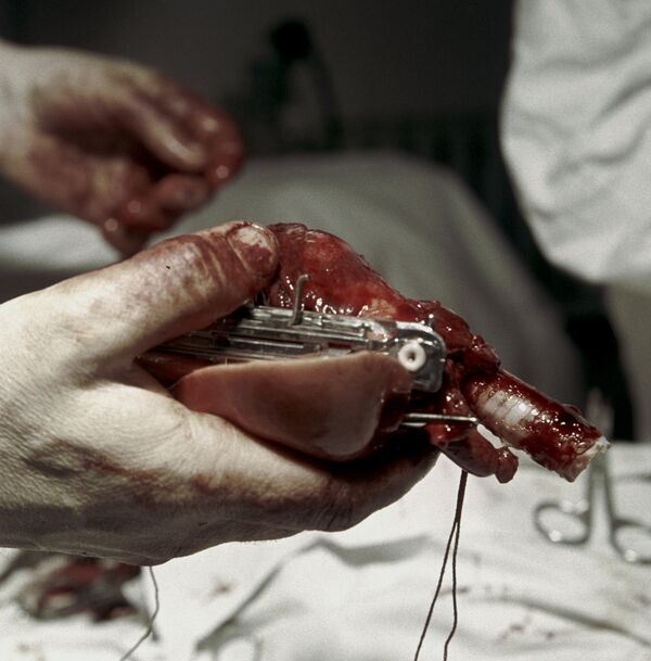 داعشی ها خرید و فروش اعضای بدن انسان را آغاز کردند - اسپوتنیک ایران  